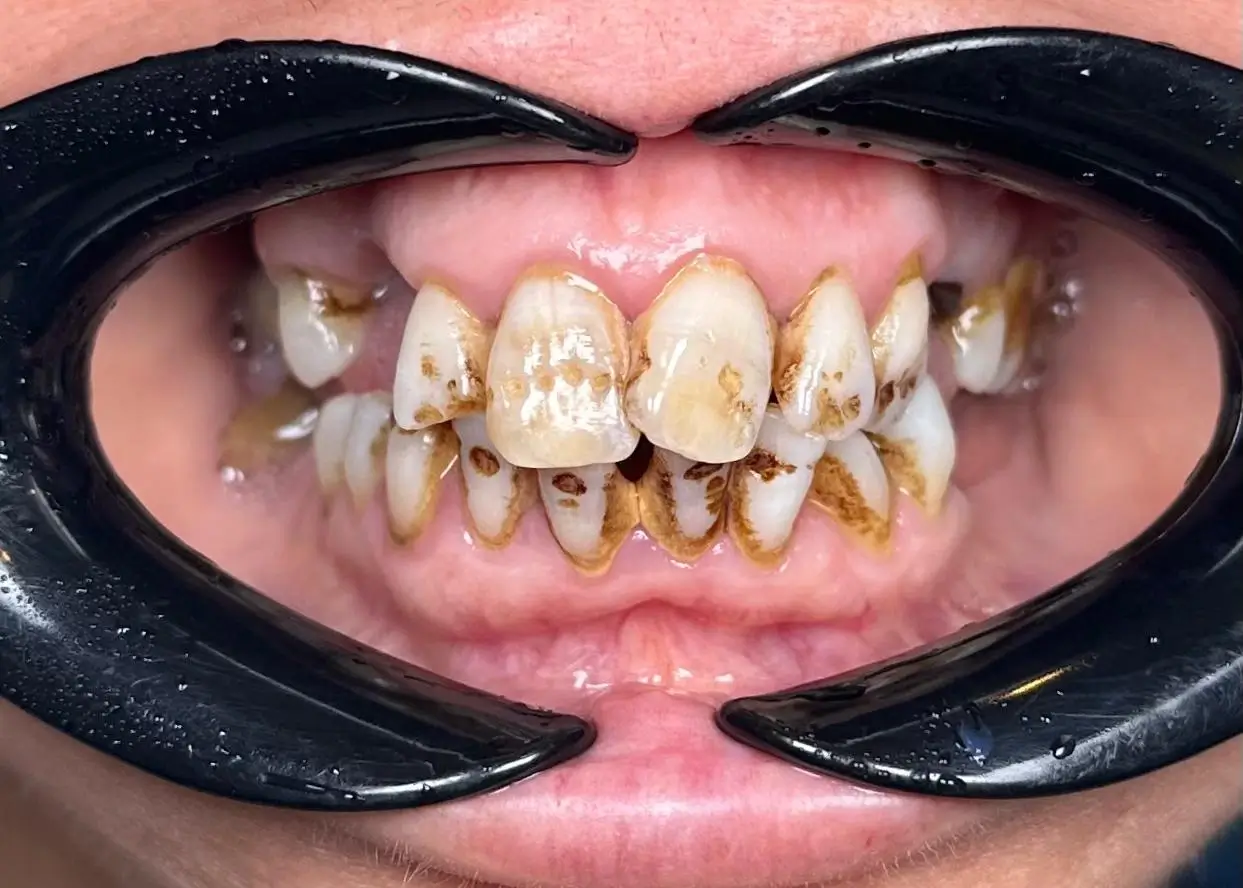 Sultanbeyli Anadolu Yakası Diş Kliniği Sağlıklı ve Estetik Gülüşler