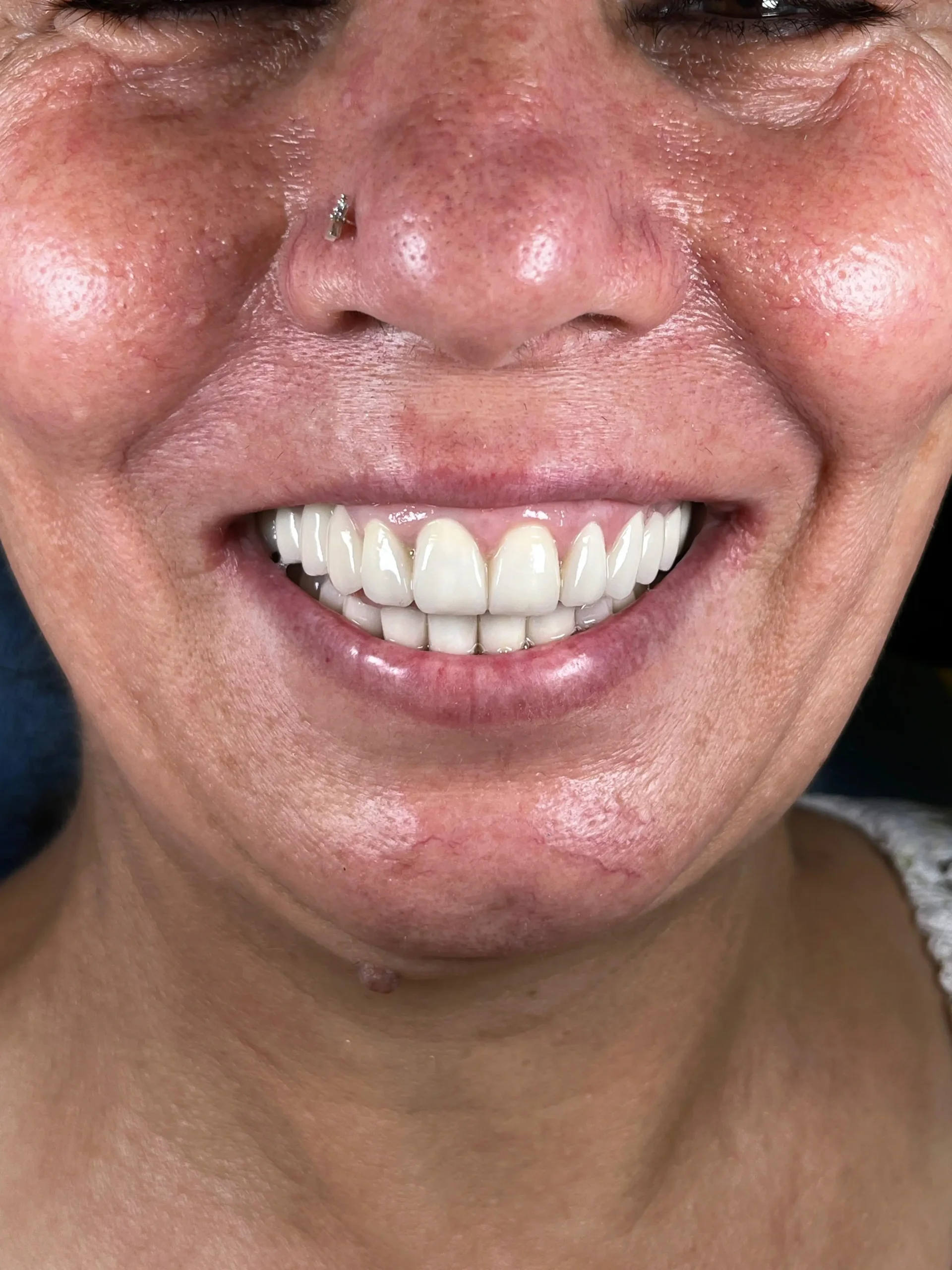 Sultanbeyli Anadolu Yakası Diş Kliniği Sağlıklı ve Estetik Gülüşler