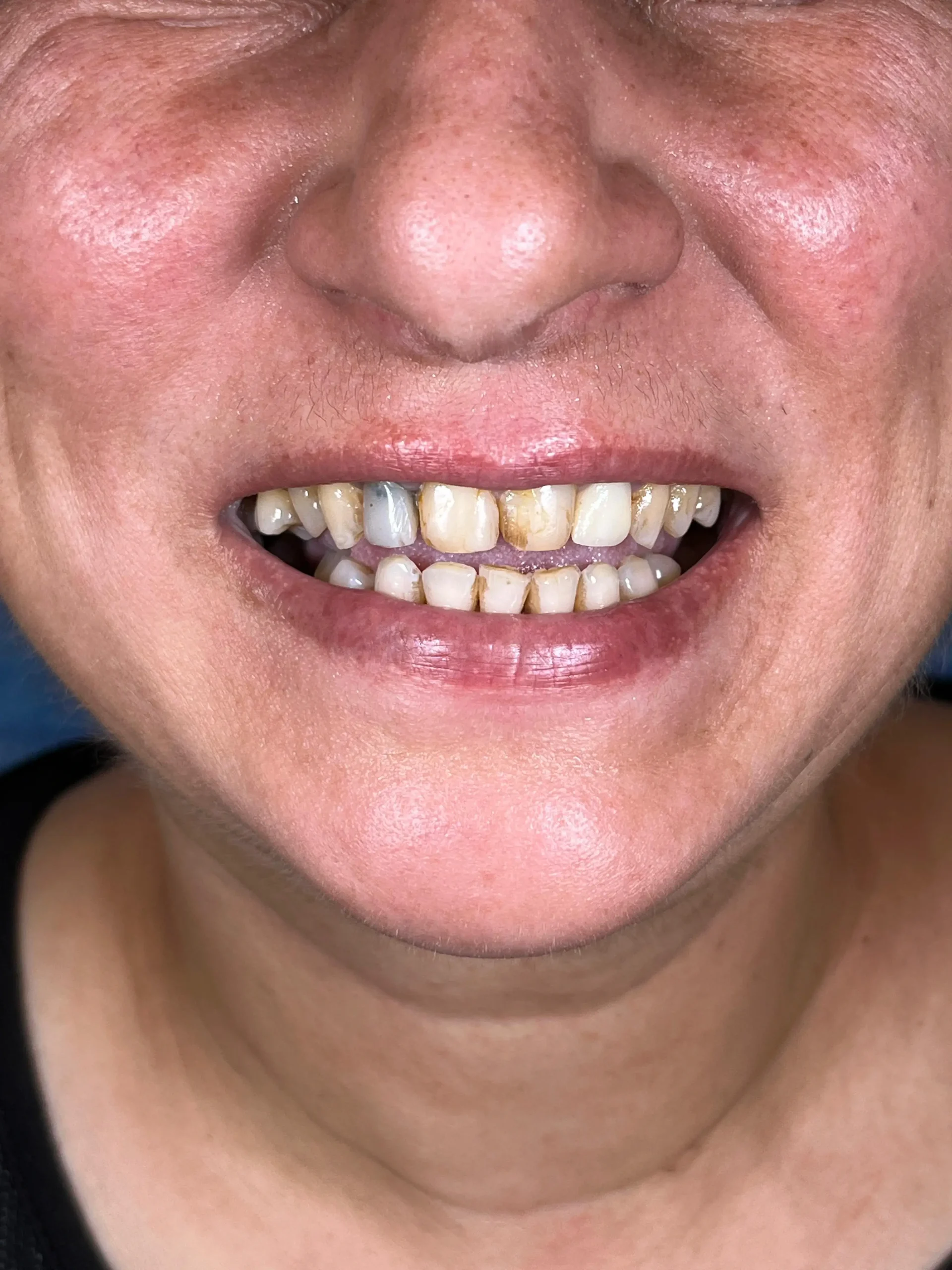 Sultanbeyli Anadolu Yakası Diş Kliniği Sağlıklı ve Estetik Gülüşler