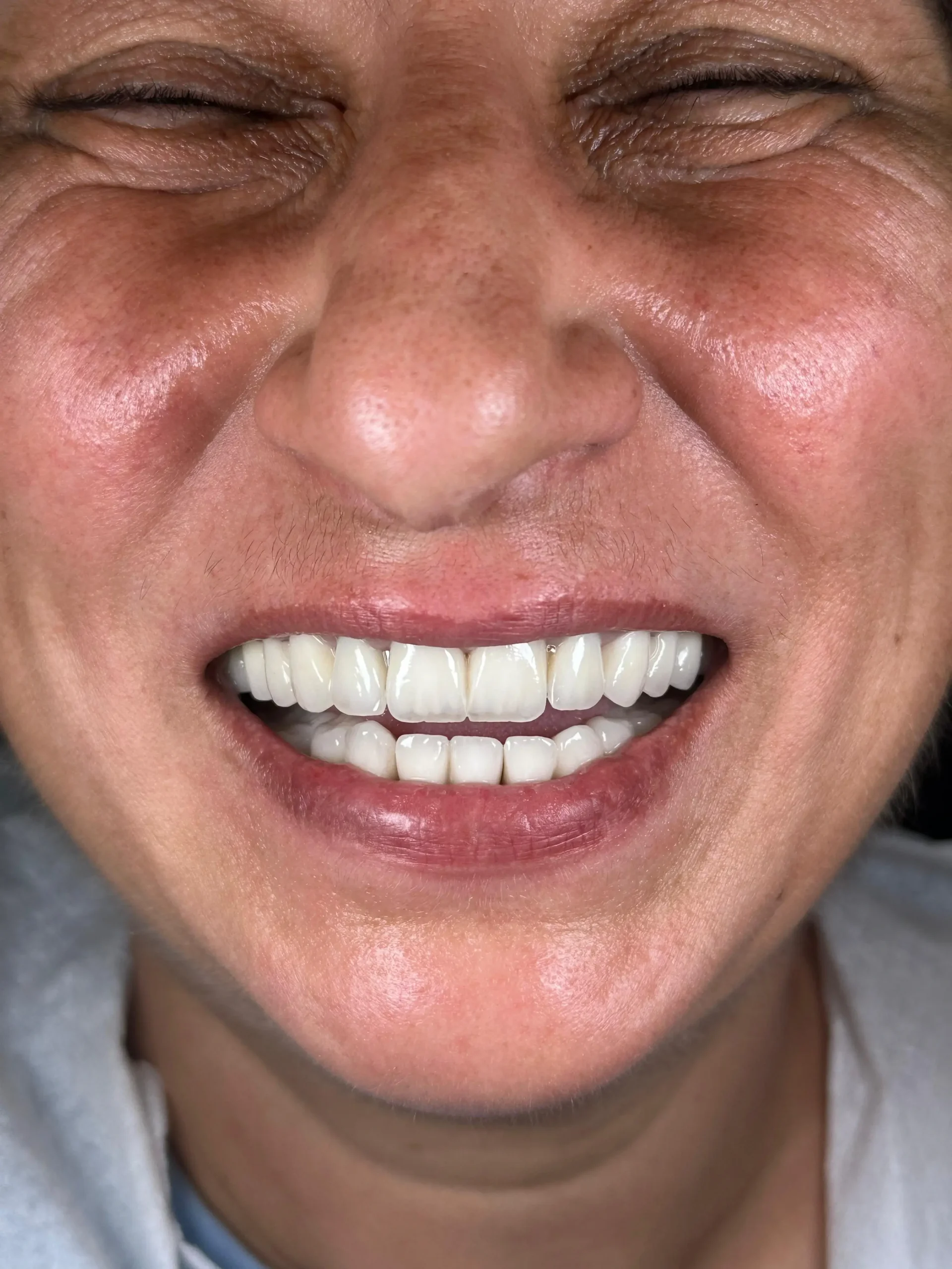 Sultanbeyli Anadolu Yakası Diş Kliniği Sağlıklı ve Estetik Gülüşler