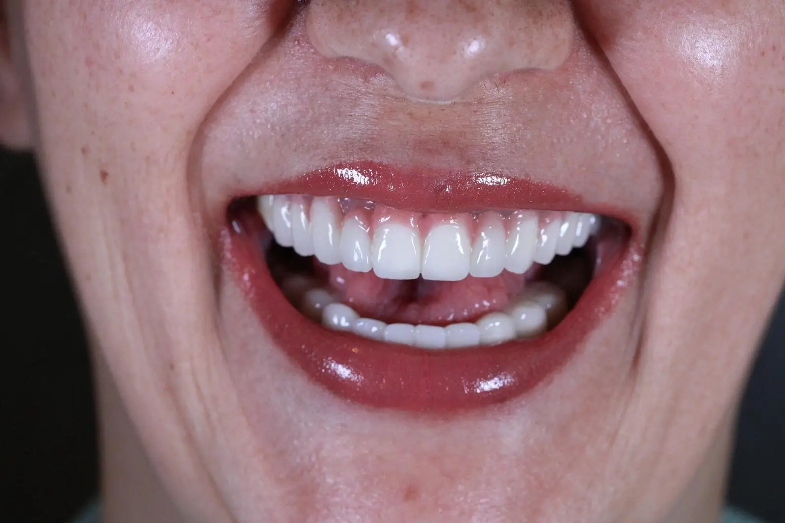 Sultanbeyli Anadolu Yakası Diş Kliniği Sağlıklı ve Estetik Gülüşler