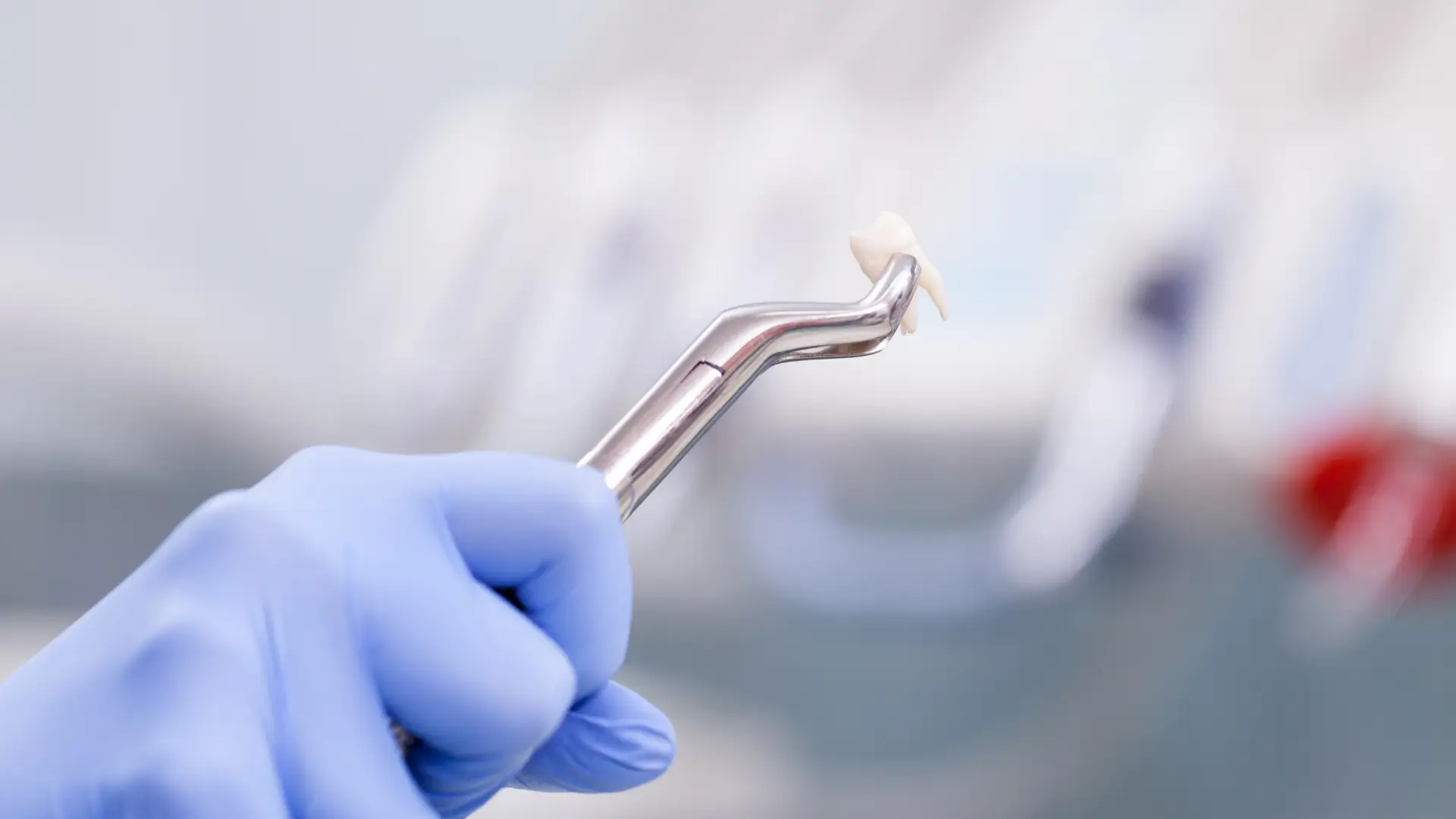 İltihaplı Diş Çekilir Mi? Apseli Diş Çekilirse Ne Olur?